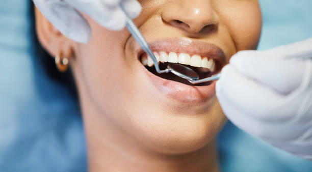 Best Mobile Emergency Dentist in Roseburg, OR