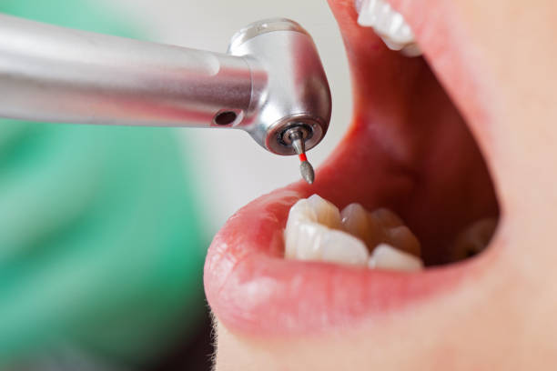 Best Pediatric Emergency Dentist in Roseburg, OR